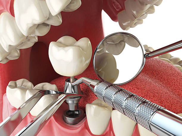 Best Emergency Gum Treatment in Bellefontaine Neighbors, MO