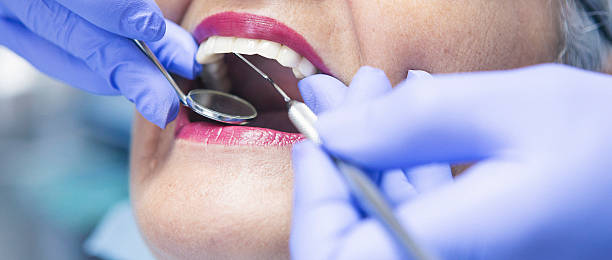 Best Emergency Dental Care for Broken or Chipped Teeth in Bellefontaine Neighbors, MO